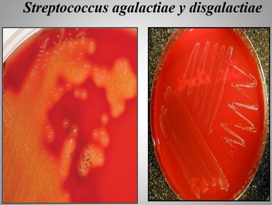 Importancia de los cultivos bacteriológicos en el diagnóstico de la mastitis bovina y antibiograma - Image 10