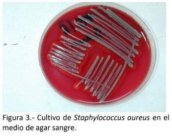 Detección de genes de resistencia a antibióticos en Staphylococcus aureus aislados de casos de mastitis bovina. - Image 4
