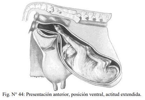 Obstetricia y neonatología bovina: XI. Estática fetal Anormal - Image 12