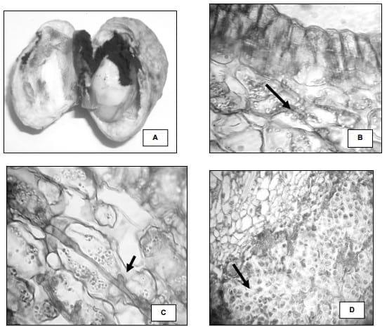 Histopatologia del carbon thecaphora frezii en arachis hypogaea - Image 1