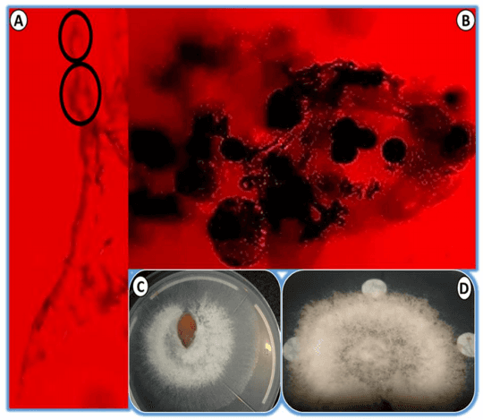 Peach Root Rot - Phymatotrichopsis omnivora - Image 10