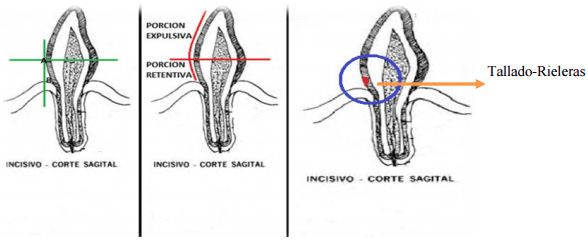 El uso de las prótesis y su influencia en el sistema productivo y reproductivo ganadero - Image 11
