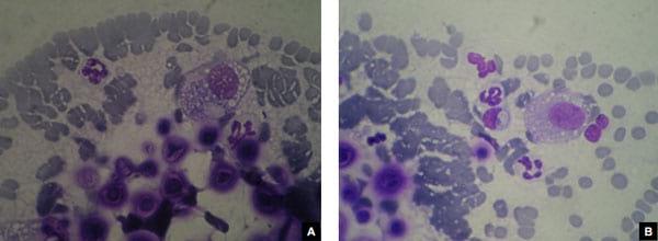 Concomitancia de infección por Cryptococcus neoformans y Hepatozoon sp. en un gato doméstico - Image 8