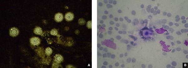 Concomitancia de infección por Cryptococcus neoformans y Hepatozoon sp. en un gato doméstico - Image 7
