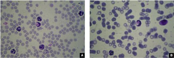 Concomitancia de infección por Cryptococcus neoformans y Hepatozoon sp. en un gato doméstico - Image 9
