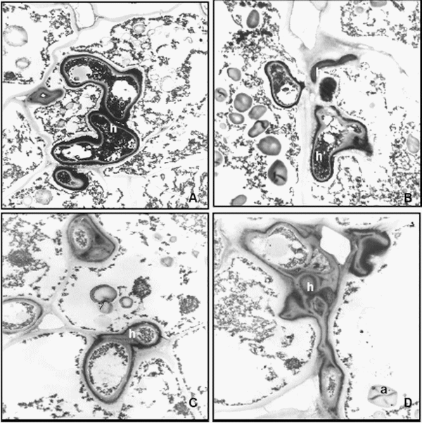 Histopatología y alteraciones morfológicas producidas por sporisorium sp. En rizomas de sorghum halepense - Image 7