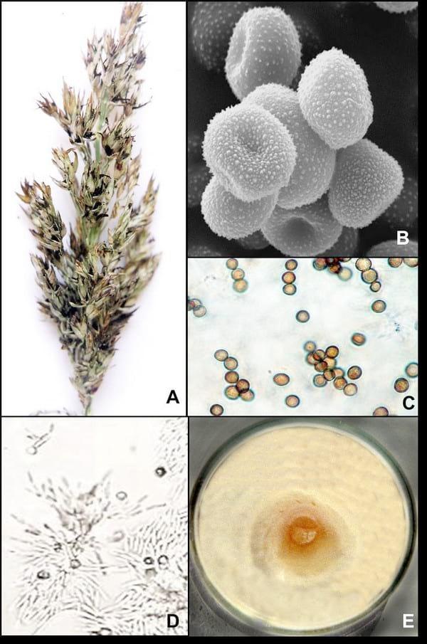 Histopatología y alteraciones morfológicas producidas por sporisorium sp. En rizomas de sorghum halepense - Image 1