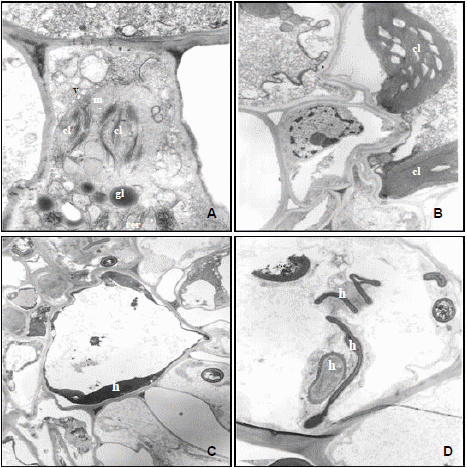Histopatología y alteraciones morfológicas producidas por sporisorium sp. En rizomas de sorghum halepense - Image 4