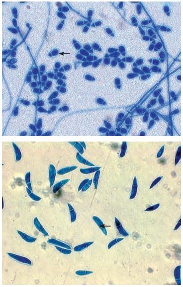 Capacidad predadora in vitro de hongos nematófagos nativos de Cundinamarca sobre nematodos gastrointestinales de bovinos - Image 2
