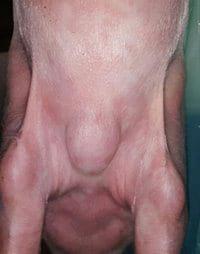 Bursitis esternal en cerdos - Image 1