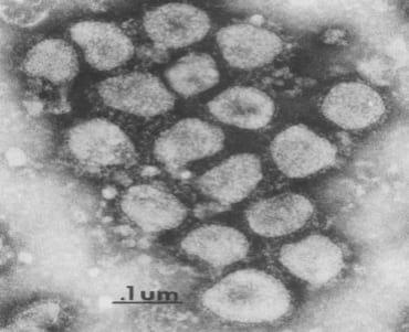 Coronavirus bovino: Infecciones neumoentéricas - Image 1