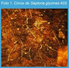 Estudios patométricos de la mancha marrón de la soja, causada por Septoria glycines, en el norte de la provincia de Buenos Aires. - Image 1