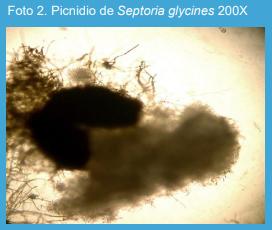 Estudios patométricos de la mancha marrón de la soja, causada por Septoria glycines, en el norte de la provincia de Buenos Aires. - Image 2