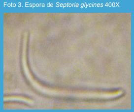 Estudios patométricos de la mancha marrón de la soja, causada por Septoria glycines, en el norte de la provincia de Buenos Aires. - Image 3
