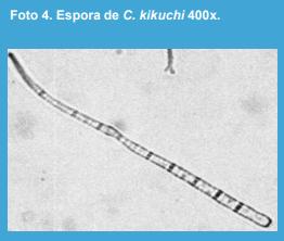 Relación entre la severidad de los síntomas del tizón foliar por Cercospora en el pecíolo y la incidencia de la mancha púrpura en las semillas causadas por Cercospora kikuchii en soja en la Argentina. - Image 4