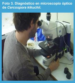 Relación entre la severidad de los síntomas del tizón foliar por Cercospora en el pecíolo y la incidencia de la mancha púrpura en las semillas causadas por Cercospora kikuchii en soja en la Argentina. - Image 3