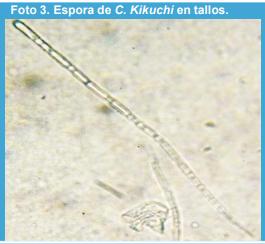 Métodos de inoculación de Cercospora kikuchii en soja (Glycine max L.) bajo condiciones contraladas en invernáculo. - Image 4