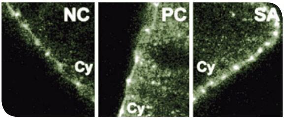 Efectos protectores de los ß-galactomananos vegetales sobre la función barrera intestinal - Image 6