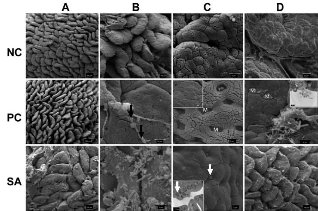 Efectos protectores de los ß-galactomananos vegetales sobre la función barrera intestinal - Image 4