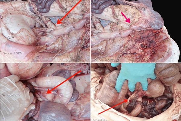 Síndrome de dilatación intestinal porcina - Image 6