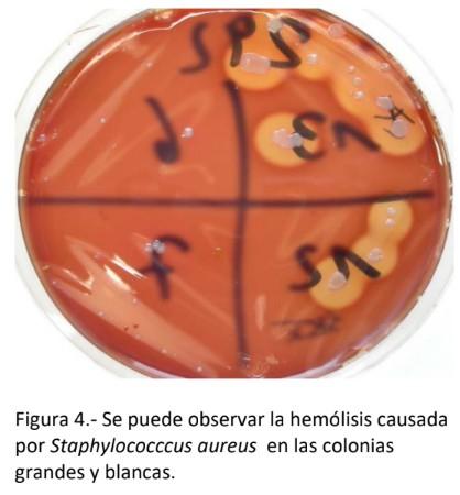 Avances en las investigaciones de Staphylococcus aureus como agente patógeno causante de Mastitis bovina, mediante biología molecular. - Image 6
