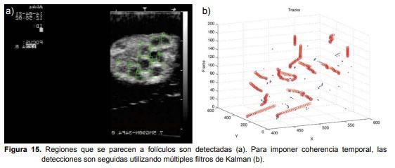 Programa recuento folicular automático. Detección de folículos en videos de ultrasonido de ovarios bovinos. - Image 2