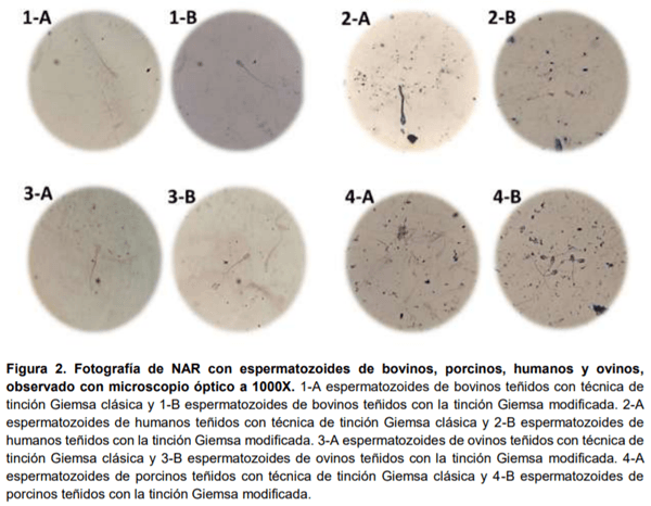 Evaluación de la técnica modificada de tinción Giemsa en la valoración acrosomal de espermatozoides de mamíferos - Image 3