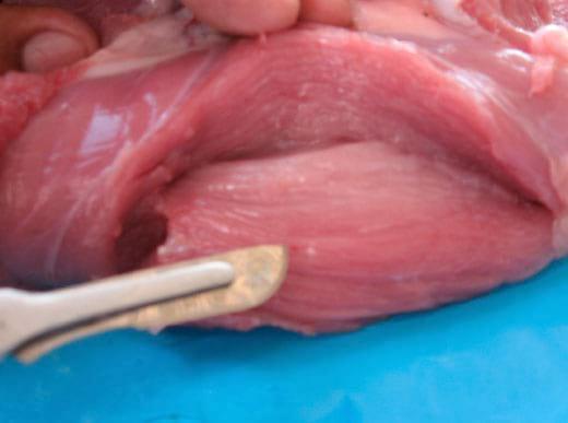Cysticercus Cellulosae en carne de cerdos, Técnicas para eliminarlo - Image 14