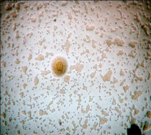 Mycoplasma gallisepticum y Mycoplasma synoviae - Image 1