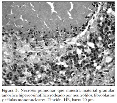 Demostración inmunohistoquímica de Mycoplasma bovis en lesiones neumónicas crónicas en ganado en corral de engorda - Image 4