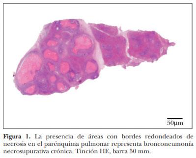 Demostración inmunohistoquímica de Mycoplasma bovis en lesiones neumónicas crónicas en ganado en corral de engorda - Image 2