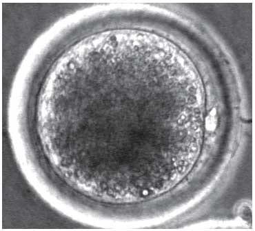 Efecto de los suplementos fluido folicular y suero fetal bovino sobre la maduración in vitro de oocitos equinos - Image 7
