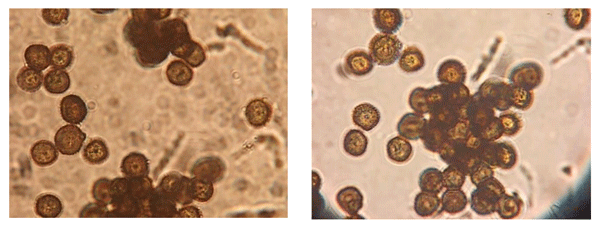 Imagen 5. Teliosporas de S. reilianum. Observación en microscopio 40x. Fotos: De Rossi & Couretot, 2021. Corral de Bustos, Córdoba.