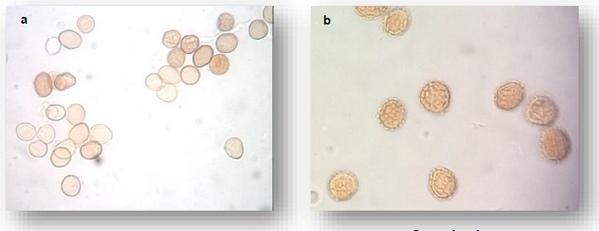 Detección de Tilletia spp (carbón cubierto) en semillas de Triticum spp - Image 1