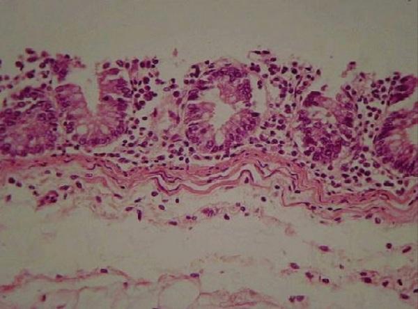 DETECCIÓN DE ILEITIS NECRÓTICA CAUSADA POR Lawsonia intracellularis EN PORCINOS DE GRANJAS TECNIFICADAS DE LA ZONA DE LIMA - Image 2