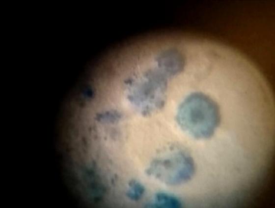 Una Lesión: poliserositis - Dos Causas: ¿H. parasuis o Mycoplasma hyorhinis? - Image 2