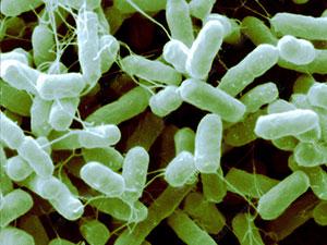 Multirresistencia bacteriana: qué es y cómo evitarla en beneficio de la salud - Image 3