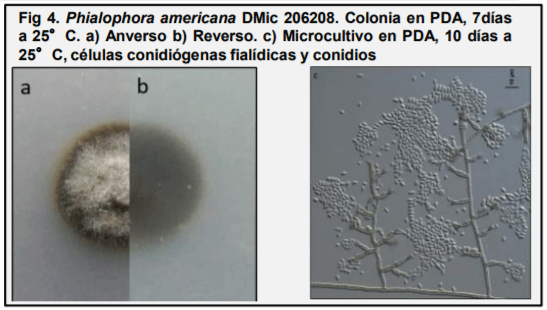 Fig 4. Phialophora americana DMic 206208. Colonia en PDA, 7días a 25°C. a) Anverso b) Reverso. c) Microcultivo en PDA, 10 días a 25°C, células conidiógenas fialídicas y conidios