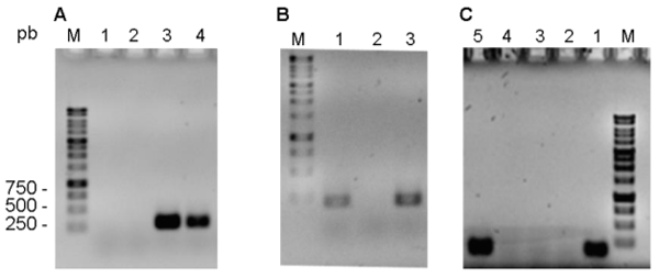Figura 1: Geles de agarosa de los resultados positivos y negativos representativos de la amplificación por PCR de: A) chuA (279 pb), B) yjaA (211 pb) y, C) TspE.C2 (152 pb)