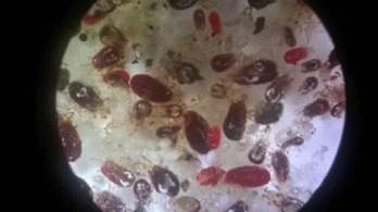 Los diferentes estadillos del ácaro rojo con el microscopio.