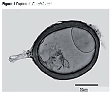 Simbiosis Micorrizica Arbuscular y Acumulación de Aluminio en Brachiaria decumbens y Manihot esculenta - Image 3