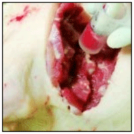Figura 6. Toma de muestra estéril de líquido cefalorraquídeo de la cisterna magna de la articulación atlanto-occipital. El fluido es, en condiciones normales, transparente, y se debe evitar su contaminación con sangre.