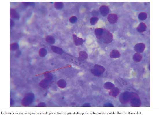Criterios y protocolos para el diagnóstico de hemoparásitos en bovinos - Image 3