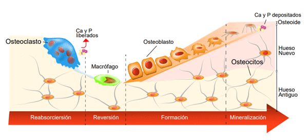 Figura 2. En la remodelación ósea, los osteoclastos absorben tejido óseo y liberan Ca y P. Los macrófagos apoyan la formación de osteoblastos del hueso y engloban cualquier osteoblasto que muera y no se incruste en el hueso nuevo. Para crear hueso nuevo, los osteoblastos primero secretan osteoide, un matriz de colágeno. Algunos osteoblastos se incrustarán en la matriz. A continuación, la matriz osteoide se calcifica mediante la adición de Ca y P.
