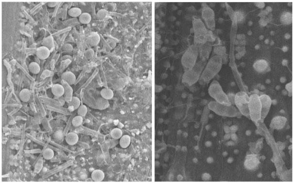 Figura 5. Micrografias de estructuras de Pleorotus ostreatus (izquierda) y Penicillium pinophilum (derecha)