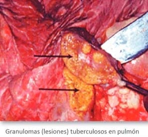 Tuberculosis: Amenaza en la salud y productividad de los Bovinos - Image 5
