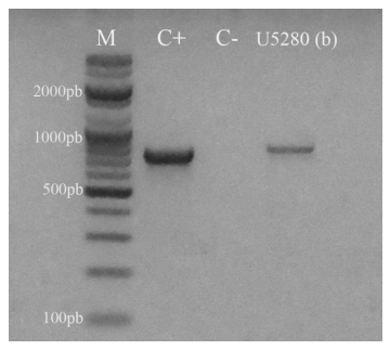 Figura 3. Gel de agarosa al 2% teñido con SYBR Safe DNA gel stain (INVITROGEN). Se observa la amplificación de un segmento de 783 pb del gen codificante de la proteína S1 del virus de la bronquitis infecciosa aviar (IBV). La muestra analizada correspondió a la codificada como U5280 y que resultó positiva a la región 5’UTR. Referencia. M: marcador de pares de bases, C+ control positivo, C- control negativo.