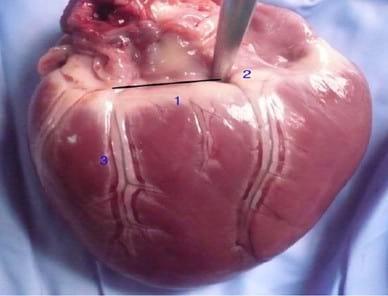 Circulación de la cara caudal del corazón canino: Región quirurgica de la Hemianuloplastia mitral - Image 3