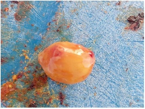 Lesiones hemorrágicas musculares como indicadores de inmunodepresión en los pollos de engorda - Image 2