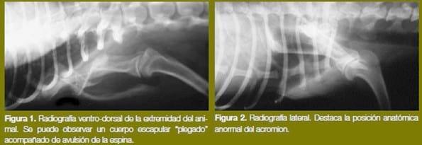 Malaunión en un caso de fractura escapular múltiple - Image 1